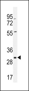 COPE Antibody - COPE Antibody western blot of A375 cell line lysates (35 ug/lane). The COPE antibody detected the COPE protein (arrow).