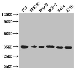 COPE Antibody - Western Blot Positive WB detected in: PC-3 whole cell lysate, HEK293 whole cell lysate, HepG2 whole cell lysate, MCF-7 whole cell lysate, Hela whole cell lysate, A375 whole cell lysate All lanes: COPE antibody at 3µg/ml Secondary Goat polyclonal to rabbit IgG at 1/50000 dilution Predicted band size: 35, 29 kDa Observed band size: 35 kDa