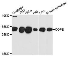 COPE Antibody - Western blot analysis of extracts of various cell lines, using COPE antibody at 1:1000 dilution. The secondary antibody used was an HRP Goat Anti-Rabbit IgG (H+L) at 1:10000 dilution. Lysates were loaded 25ug per lane and 3% nonfat dry milk in TBST was used for blocking. An ECL Kit was used for detection and the exposure time was 90s.
