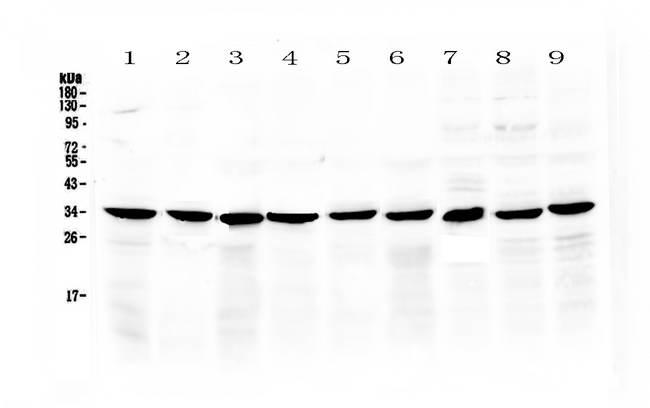 COPE Antibody - Western blot analysis of COPE using anti-COPE antibody. Electrophoresis was performed on a 5-20% SDS-PAGE gel at 70V (Stacking gel) / 90V (Resolving gel) for 2-3 hours. The sample well of each lane was loaded with 50ug of sample under reducing conditions. Lane 1: rat stomach tissue lysate,Lane 2: rat small intestine tissue lysate,Lane 3: rat pancreas tissue lysate,Lane 4: mouse stomach tissue lysate,Lane 5: mouse small intestine tissue lysate,Lane 6: mouse pancreas tissue lysate,Lane 7: human MCF-7 whole Cell lysatem,Lane 8: human Hela whole Cell lysate,Lane 9: human 22RV1 whole Cell lysate. After Electrophoresis, proteins were transferred to a Nitrocellulose membrane at 150mA for 50-90 minutes. Blocked the membrane with 5% Non-fat Milk/ TBS for 1.5 hour at RT. The membrane was incubated with rabbit anti-COPE antigen affinity purified polyclonal antibody at 0.5 µg/mL overnight at 4°C, then washed with TBS-0.1% Tween 3 times with 5 minutes each and probed with a goat anti-rabbit IgG-HRP secondary antibody at a dilution of 1:10000 for 1.5 hour at RT. The signal is developed using an Enhanced Chemiluminescent detection (ECL) kit with Tanon 5200 system. A specific band was detected for COPE at approximately 34KD. The expected band size for COPE is at 34KD.