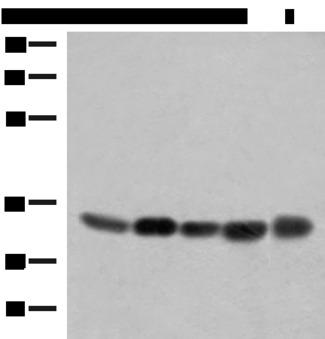 COPE Antibody - Western blot analysis of 231 PC-3 Hela A375 HepG2 cell lysates  using COPE Polyclonal Antibody at dilution of 1:350