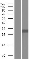 COPE Protein - Western validation with an anti-DDK antibody * L: Control HEK293 lysate R: Over-expression lysate