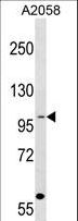 COPG / Gamma-COP Antibody - COPG Antibody western blot of A2058 cell line lysates (35 ug/lane). The COPG antibody detected the COPG protein (arrow).