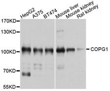 COPG / Gamma-COP Antibody - Western blot analysis of extracts of various cell lines, using COPG1 antibody at 1:1000 dilution. The secondary antibody used was an HRP Goat Anti-Rabbit IgG (H+L) at 1:10000 dilution. Lysates were loaded 25ug per lane and 3% nonfat dry milk in TBST was used for blocking. An ECL Kit was used for detection and the exposure time was 1s.