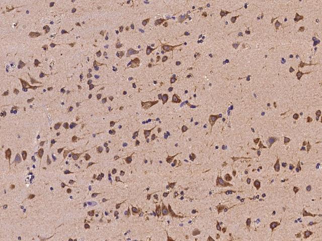 COPG / Gamma-COP Antibody - Immunochemical staining of human COPG in human brain with rabbit polyclonal antibody at 1:300 dilution, formalin-fixed paraffin embedded sections.