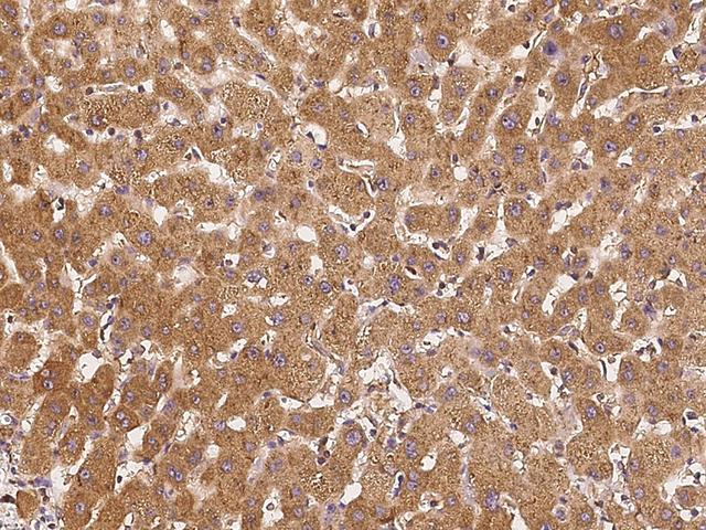 COPG / Gamma-COP Antibody - Immunochemical staining of human COPG in human liver with rabbit polyclonal antibody at 1:300 dilution, formalin-fixed paraffin embedded sections.