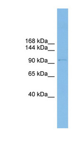 COPG / Gamma-COP Antibody - COPG antibody Western blot of THP-1 cell lysate. This image was taken for the unconjugated form of this product. Other forms have not been tested.