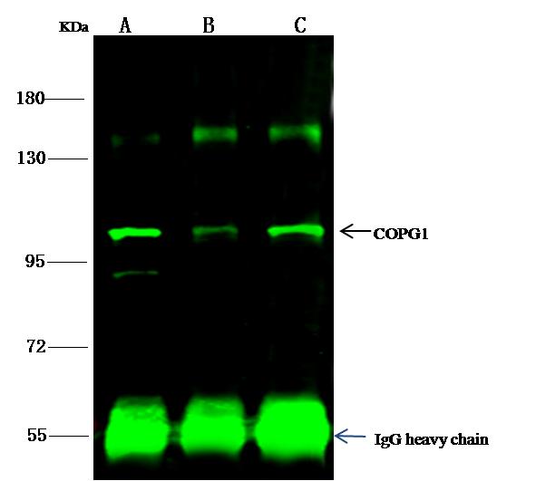 COPG / Gamma-COP Antibody - COPG1 was immunoprecipitated using: Lane A: 0.5 mg THP-1 Whole Cell Lysate. Lane B: 0.5 mg HUT-78 Whole Cell Lysate. Lane C:0.5 mg U87MG Whole Cell Lysate. 1 uL anti-COPG1 rabbit polyclonal antibody and 15 ul of 50% Protein G agarose. Primary antibody: Anti-COPG1 rabbit polyclonal antibody, at 1:500 dilution. Secondary antibody: Dylight 800-labeled antibody to rabbit IgG (H+L), at 1:5000 dilution. Developed using the odssey technique. Performed under reducing conditions. Predicted band size: 96 kDa. Observed band size: 96 kDa.