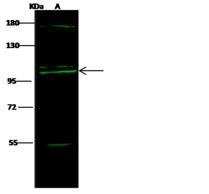 COPG / Gamma-COP Antibody - Anti-COPG1 rabbit polyclonal antibody at 1:500 dilution. Lane A: THP1 Whole Cell Lysate. Lysates/proteins at 30 ug per lane. Secondary: Goat Anti-Rabbit IgG H&L (Dylight 800) at 1/10000 dilution. Developed using the Odyssey technique. Performed under reducing conditions. Predicted band size: 105 kDa. Observed band size: 105 kDa. (We are unsure as to the identity of these extra bands.)