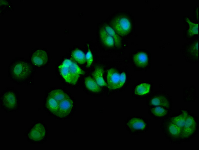 COPG2 Antibody - Immunofluorescence staining of MCF-7 cells at a dilution of 1:133, counter-stained with DAPI. The cells were fixed in 4% formaldehyde, permeabilized using 0.2% Triton X-100 and blocked in 10% normal Goat Serum. The cells were then incubated with the antibody overnight at 4 °C.The secondary antibody was Alexa Fluor 488-congugated AffiniPure Goat Anti-Rabbit IgG (H+L) .