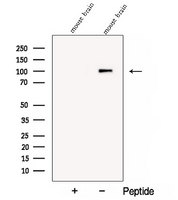 COPG2 Antibody - Western blot analysis of extracts of mouse brain tissue using COPG2 antibody. The lane on the left was treated with blocking peptide.
