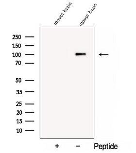 COPG2 Antibody - Western blot analysis of extracts of mouse brain tissue using COPG2 antibody. The lane on the left was treated with blocking peptide.