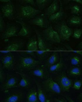 COPG2 Antibody - Immunofluorescence analysis of U-2OS cells using COPG2 Polyclonal Antibody at dilution of 1:100 (40x lens).Blue: DAPI for nuclear staining.