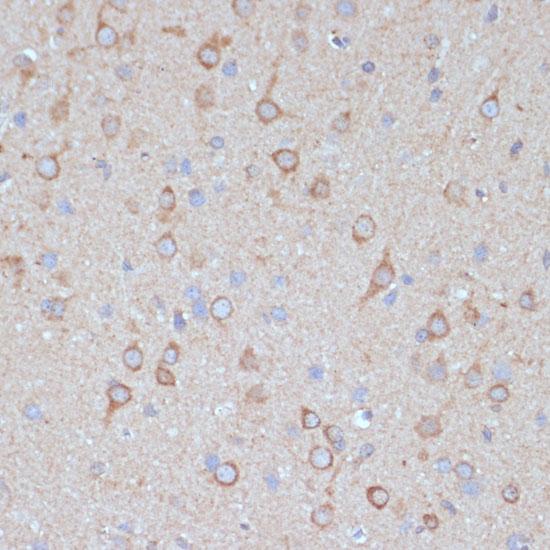 COPG2 Antibody - Immunohistochemistry of paraffin-embedded Rat brain using COPG2 Polyclonal Antibody at dilution of 1:100 (40x lens).