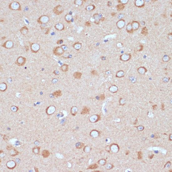 COPG2 Antibody - Immunohistochemistry of paraffin-embedded Mouse brain using COPG2 Polyclonal Antibody at dilution of 1:100 (40x lens).