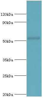 COPS2 / TRIP15 / ALIEN Antibody - Western blot. All lanes: COP9 signalosome complex subunit 2 antibody at 6 ug/ml+mouse skeletal muscle tissue. Secondary antibody: Goat polyclonal to rabbit at 1:10000 dilution. Predicted band size: 52 kDa. Observed band size: 52 kDa Immunohistochemistry.