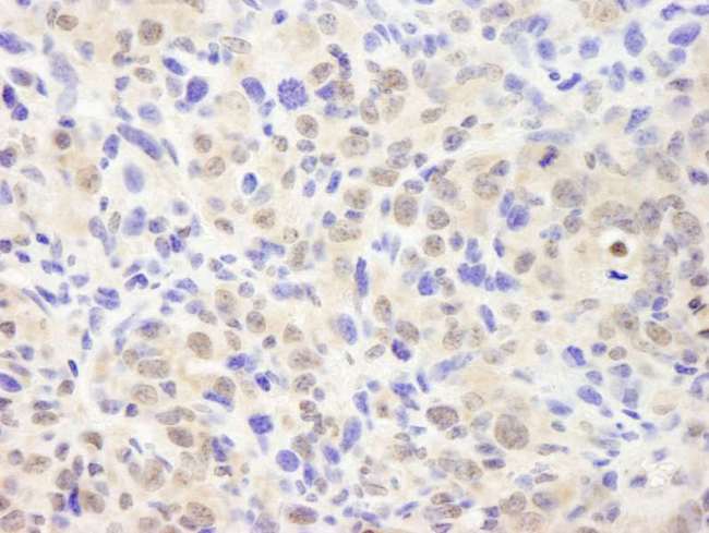 COPS2 / TRIP15 / ALIEN Antibody - Detection of Mouse CSN2 by Immunohistochemistry. Sample: FFPE section of mouse squamous cell carcinoma. Antibody: Affinity purified rabbit anti-CSN2 used at a dilution of 1:500.