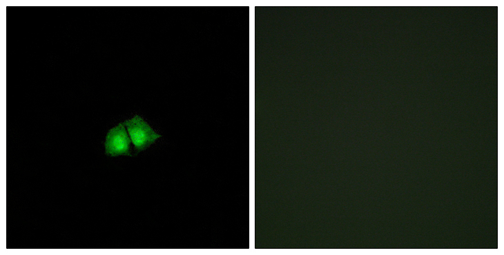 COPS2 / TRIP15 / ALIEN Antibody - Immunofluorescence analysis of A549 cells, using COPS2 Antibody. The picture on the right is blocked with the synthesized peptide.