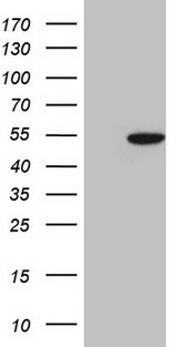 COPS3 / CSN3 Antibody - HEK293T cells were transfected with the pCMV6-ENTRY control. (Left lane) or pCMV6-ENTRY COPS3. (Right lane) cDNA for 48 hrs and lysed. Equivalent amounts of cell lysates. (5 ug per lane) were separated by SDS-PAGE and immunoblotted with anti-COPS3. (1:2000)