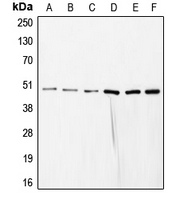 COPS3 / CSN3 Antibody - Western blot analysis of COPS3 expression in HeLa (A); SP2/0 (B); mouse liver (C); rat liver (D); NIH3T3 (E); HEK293T (F) whole cell lysates.