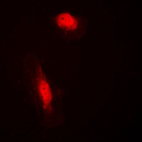 COPS3 / CSN3 Antibody - Immunofluorescent analysis of COPS3 staining in HeLa cells. Formalin-fixed cells were permeabilized with 0.1% Triton X-100 in TBS for 5-10 minutes and blocked with 3% BSA-PBS for 30 minutes at room temperature. Cells were probed with the primary antibody in 3% BSA-PBS and incubated overnight at 4 C in a humidified chamber. Cells were washed with PBST and incubated with a DyLight 594-conjugated secondary antibody (red) in PBS at room temperature in the dark. DAPI was used to stain the cell nuclei (blue).