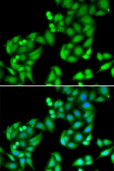 COPS3 / CSN3 Antibody - Immunofluorescence analysis of U20S cells.