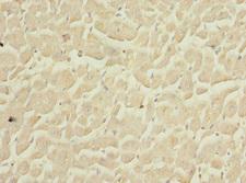 COPS3 / CSN3 Antibody - Immunohistochemistry of paraffin-embedded human heart tissue at dilution 1:100