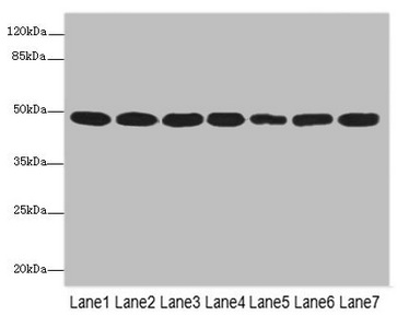COPS3 / CSN3 Antibody - Western blot All Lanes: COPS3antibody at 3.41ug/ml Lane 1 : MCF7 whole cell lysate Lane 2 : Hela whole cell lysate Lane 3 : 293T whole cell lysate Lane 4 : HT29 whole cell lysate Lane 5 : Mouse heart tissue Lane 6 : Mouse brain tissue Lane 7 : Mouse ovarian tissue Secondary Goat polyclonal to Rabbit IgG at 1/10000 dilution Predicted band size: 48,46 kDa Observed band size: 45 kDa