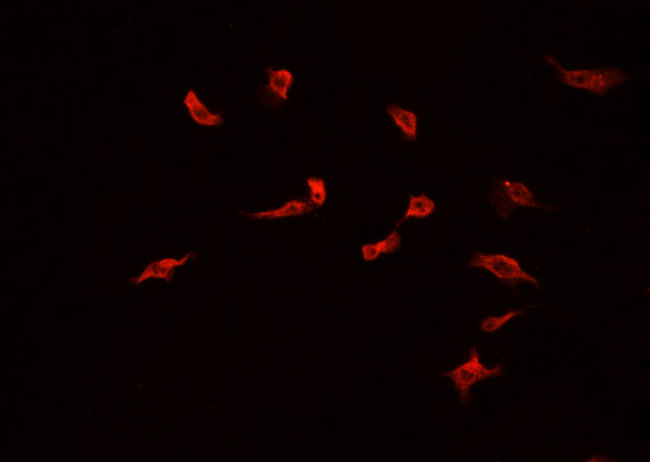COPS3 / CSN3 Antibody - Staining LOVO cells by IF/ICC. The samples were fixed with PFA and permeabilized in 0.1% Triton X-100, then blocked in 10% serum for 45 min at 25°C. The primary antibody was diluted at 1:200 and incubated with the sample for 1 hour at 37°C. An Alexa Fluor 594 conjugated goat anti-rabbit IgG (H+L) Ab, diluted at 1/600, was used as the secondary antibody.