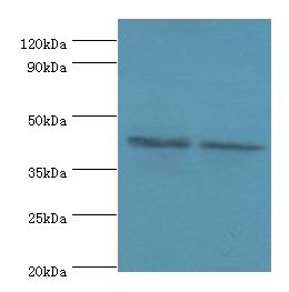 COPS4 / CSN4 Antibody - Western blot. All lanes: COPS4 antibody at 8 ug/ml. Lane 1: HeLa whole cell lysate. Lane 2: HepG2 whole cell lysate. Secondary antibody: Goat polyclonal to rabbit at 1:10000 dilution. Predicted band size: 46 kDa. Observed band size: 46 kDa.