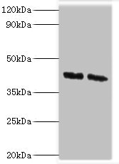 COPS4 / CSN4 Antibody - Western blot All lanes: COPS4 antibody at 8µg/ml Lane 1: Hela whole cell lysate Lane 2: HepG2 whole cell lysate Secondary Goat polyclonal to rabbit IgG at 1/10000 dilution Predicted band size: 47, 41 kDa Observed band size: 47 kDa