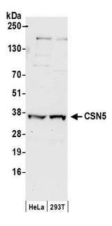 COPS5 / JAB1 Antibody - Detection of human CSN5 by western blot. Samples: Whole cell lysate (50 µg) from HeLa and HEK293T cells prepared using NETN lysis buffer. Antibodies: Affinity purified rabbit anti-CSN5 antibody used for WB at 0.2 µg/ml. Detection: Chemiluminescence with an exposure time of 10 seconds.