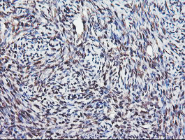 COPS5 / JAB1 Antibody - IHC of paraffin-embedded Human Ovary tissue using anti-COPS5 mouse monoclonal antibody.