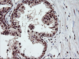 COPS5 / JAB1 Antibody - IHC of paraffin-embedded Human prostate tissue using anti-COPS5 mouse monoclonal antibody.