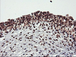 COPS5 / JAB1 Antibody - IHC of paraffin-embedded Human bladder tissue using anti-COPS5 mouse monoclonal antibody.