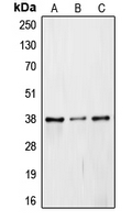 COPS5 / JAB1 Antibody - Western blot analysis of JAB1 expression in Caki1 (A); mouse embryo (B); rat liver (C) whole cell lysates.