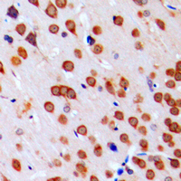 COPS5 / JAB1 Antibody - Immunohistochemical analysis of JAB1 staining in human brain formalin fixed paraffin embedded tissue section. The section was pre-treated using heat mediated antigen retrieval with sodium citrate buffer (pH 6.0). The section was then incubated with the antibody at room temperature and detected using an HRP conjugated compact polymer system. DAB was used as the chromogen. The section was then counterstained with hematoxylin and mounted with DPX.