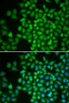 COPS5 / JAB1 Antibody - Immunofluorescence analysis of HeLa cells using COPS5 antibody. Blue: DAPI for nuclear staining.