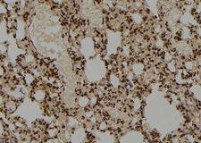 COPS5 / JAB1 Antibody - 1:100 staining rat lung tissue by IHC-P. The sample was formaldehyde fixed and a heat mediated antigen retrieval step in citrate buffer was performed. The sample was then blocked and incubated with the antibody for 1.5 hours at 22°C. An HRP conjugated goat anti-rabbit antibody was used as the secondary.