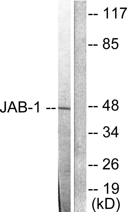 COPS5 / JAB1 Antibody - Forskolin + - Western blot analysis of extracts from LOVO cells, using JAB1 antibody.
