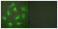 COPS5 / JAB1 Antibody - Immunofluorescence analysis of HeLa cells, treated with Forskolin (40nM, 30mins), using JAB1 antibody.