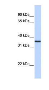 COPS5 / JAB1 Antibody - COPS5 antibody Western blot of Fetal Muscle lysate. This image was taken for the unconjugated form of this product. Other forms have not been tested.