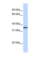 COPS5 / JAB1 Antibody - COPS5 antibody Western blot of Fetal Muscle lysate. This image was taken for the unconjugated form of this product. Other forms have not been tested.