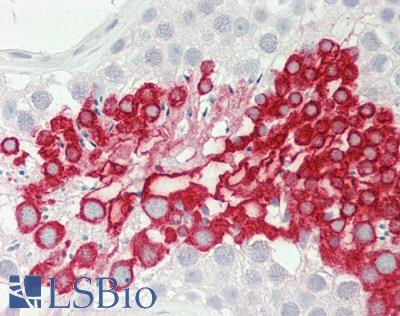 COPS6 / CSN6 Antibody - Human Testis: Formalin-Fixed, Paraffin-Embedded (FFPE).  This image was taken for the unconjugated form of this product. Other forms have not been tested.