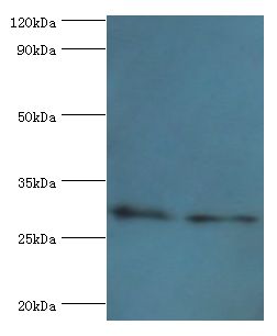 COPS7A Antibody - Western blot. All lanes: COP9 signalosome complex subunit 7a antibody at 4 ug/ml. Lane 1: rat heart tissue. Lane 2: rat brain tissue. Secondary antibody: Goat polyclonal to rabbit at 1:10000 dilution. Predicted band size: 30 kDa. Observed band size: 30 kDa Immunohistochemistry.