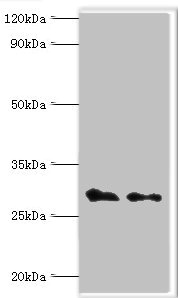 COPS7A Antibody - Western blot All lanes: COP9 signalosome complex subunit 7a antibody at 4µg/ml Lane 1: Rat heart tissue Lane 2: Rat brain tissue Secondary Goat polyclonal to rabbit IgG at 1/10000 dilution Predicted band size: 30 kDa Observed band size: 30 kDa