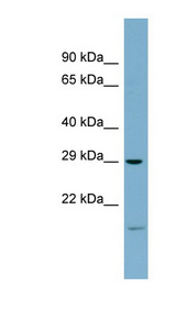 COPS7A Antibody - COPS7A antibody Western blot of Fetal Heart lysate. This image was taken for the unconjugated form of this product. Other forms have not been tested.