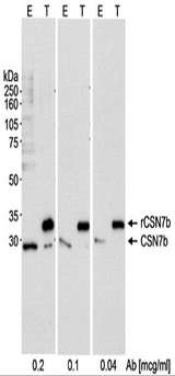 COPS7B / CSN7B Antibody - Detection of Human CSN7b by Western Blot. Samples: Whole cell lysate (50 ug - E; 10 ug - T) from HEK293T cells with (T) or without (E) with a CSN7b expression construct. Antibody: Affinity purified rabbit anti-CSN7b antibody used at the indicated concentrations. Detection: Chemiluminescence with an exposure time of 10 seconds.