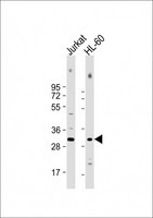 COPS7B / CSN7B Antibody - All lanes: Anti-COPS7B Antibody (Center) at 1:500-1:1000 dilution Lane 1: Jurkat whole cell lysate Lane 2: HL-60 whole cell lysate Lysates/proteins at 20 µg per lane. Secondary Goat Anti-Rabbit IgG, (H+L), Peroxidase conjugated at 1/10000 dilution. Predicted band size: 30 kDa Blocking/Dilution buffer: 5% NFDM/TBST.