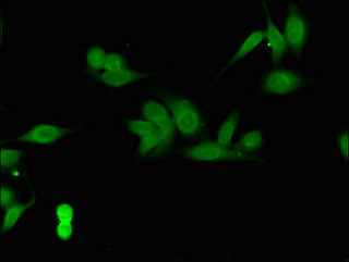 COPS7B / CSN7B Antibody - Immunofluorescent analysis of Hela cells using COPS7B Antibody at dilution of 1:100 and Alexa Fluor 488-congugated AffiniPure Goat Anti-Rabbit IgG(H+L)